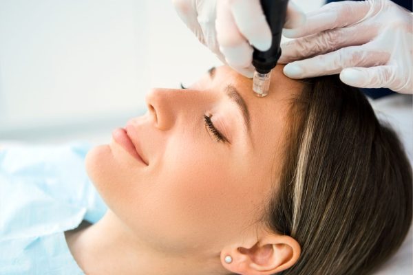 Micro Needling